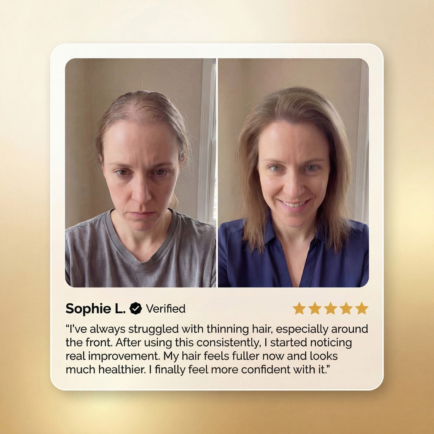 Transpre™ Advanced Batana Hair Regrowth Therapy