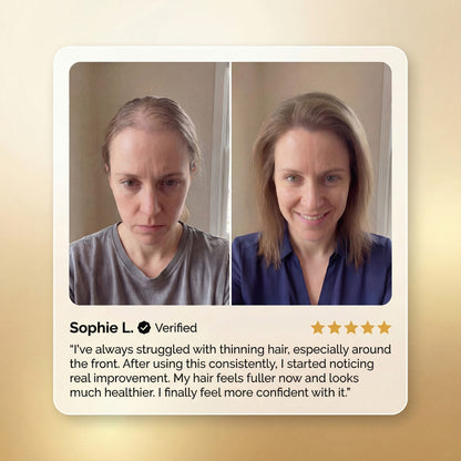 Transpre™ Advanced Batana Hair Regrowth Therapy