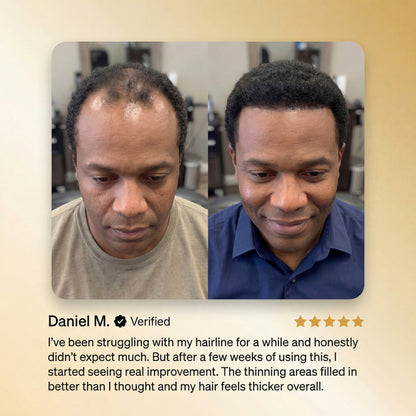Transpre™ Advanced Batana Hair Regrowth Therapy