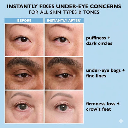 Transpre™ Instant Face Temporary Tightener – Instant visible results in 60 seconds